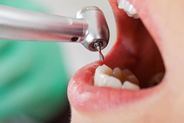 Best Emergency Treatment for Oral Infections in Pecos, TX